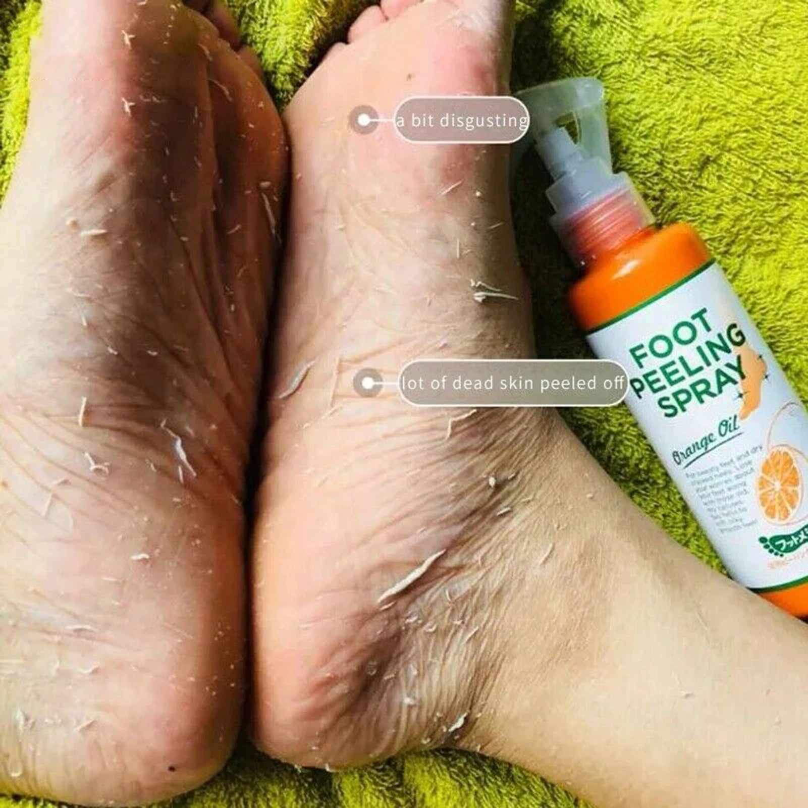 Foot Peeling Spray – Whole Body Use (110ML) - Bitora